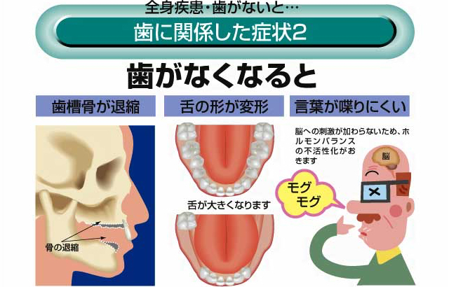 歯に関係した症状2