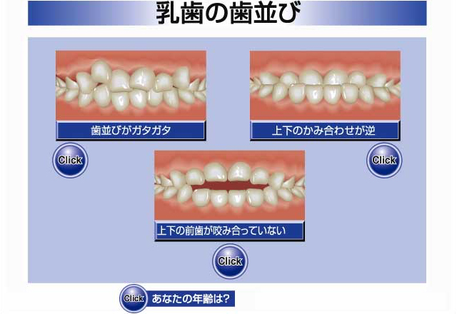 乳歯の歯並び