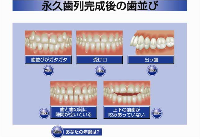 永久歯列完成後の歯並び