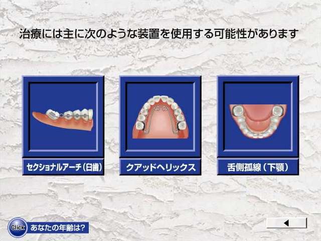 第二小臼歯の生える場所がない、あるいは歯列外に生えてきた